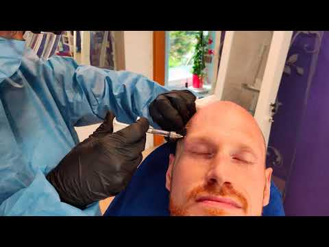Videovorschau Fettgewebe-Lifting